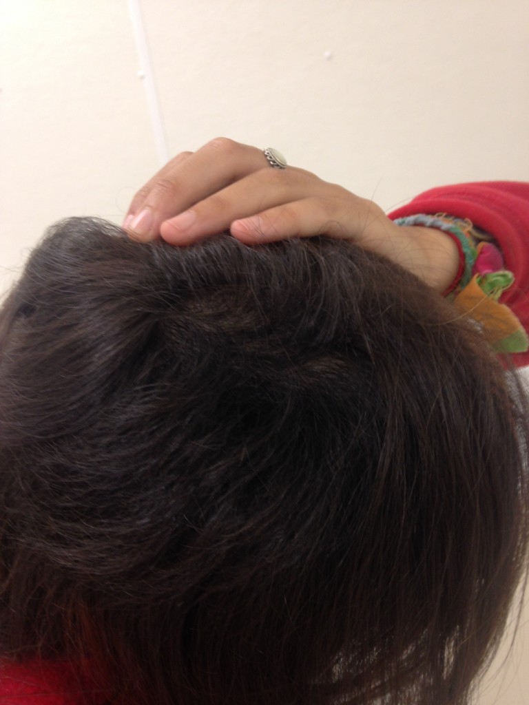 All the regrowth!