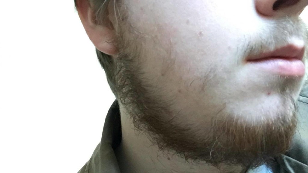 patchy beard facial hair