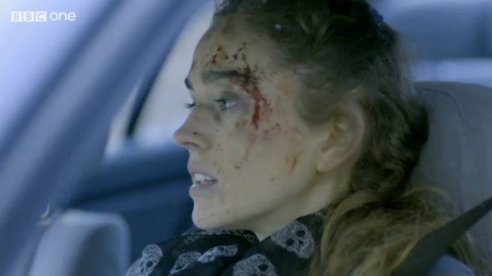 A blood smeared Lucy in Casualty