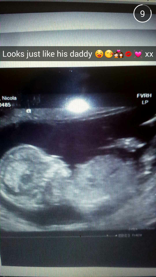 Chelsea-Leigh-Pink-Champagne's baby brother, Tyler-Mackenzie-Donny-Rovers