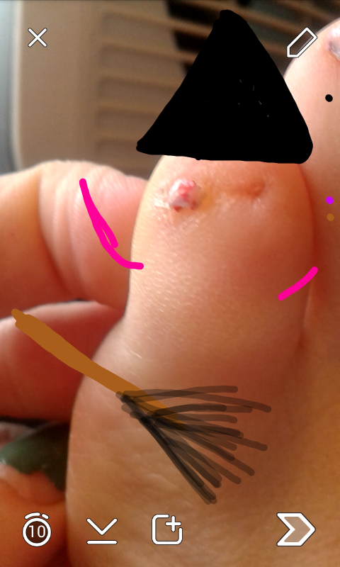 Witch toe