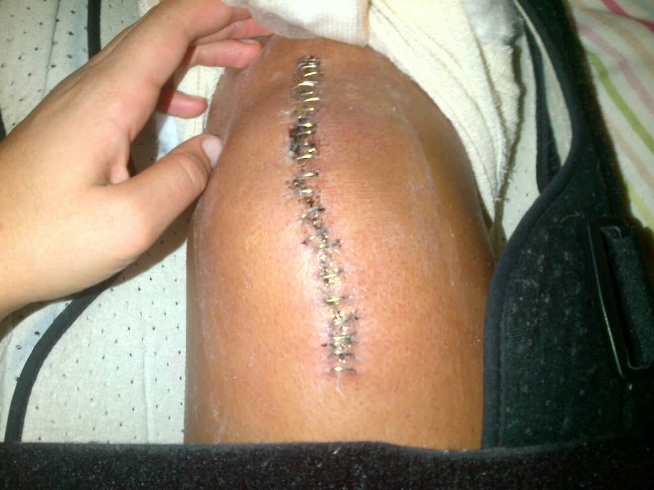 kittys kneecap knock-out