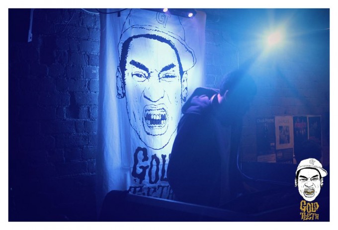 gold teeth