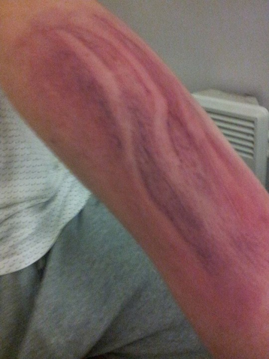 a recreation of what the scratches looked like