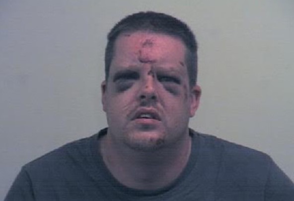 Holmes left bruised after the attack