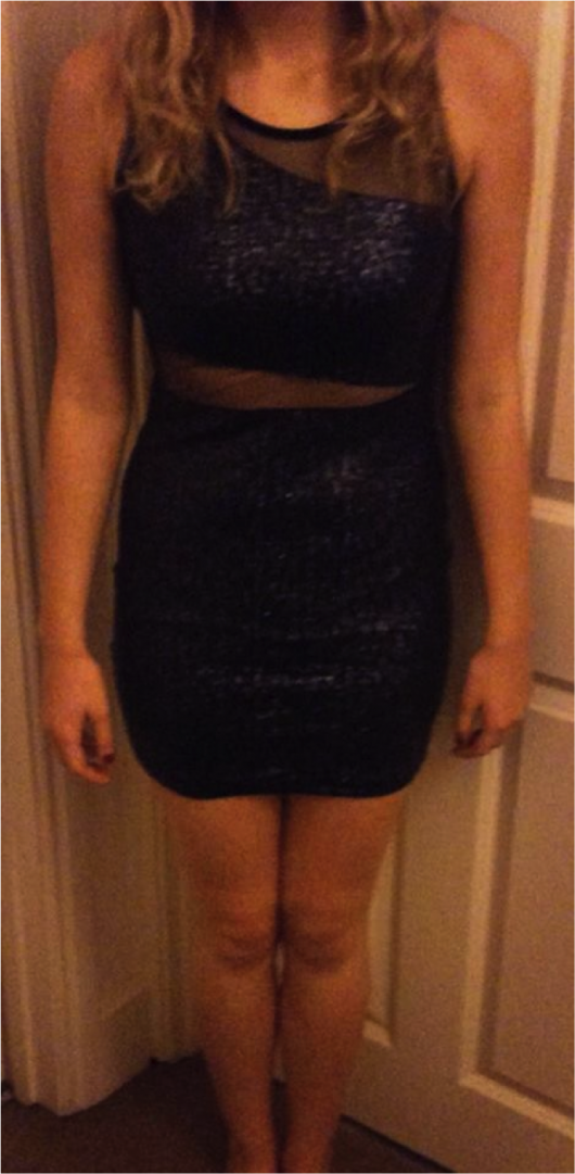 dressglitter