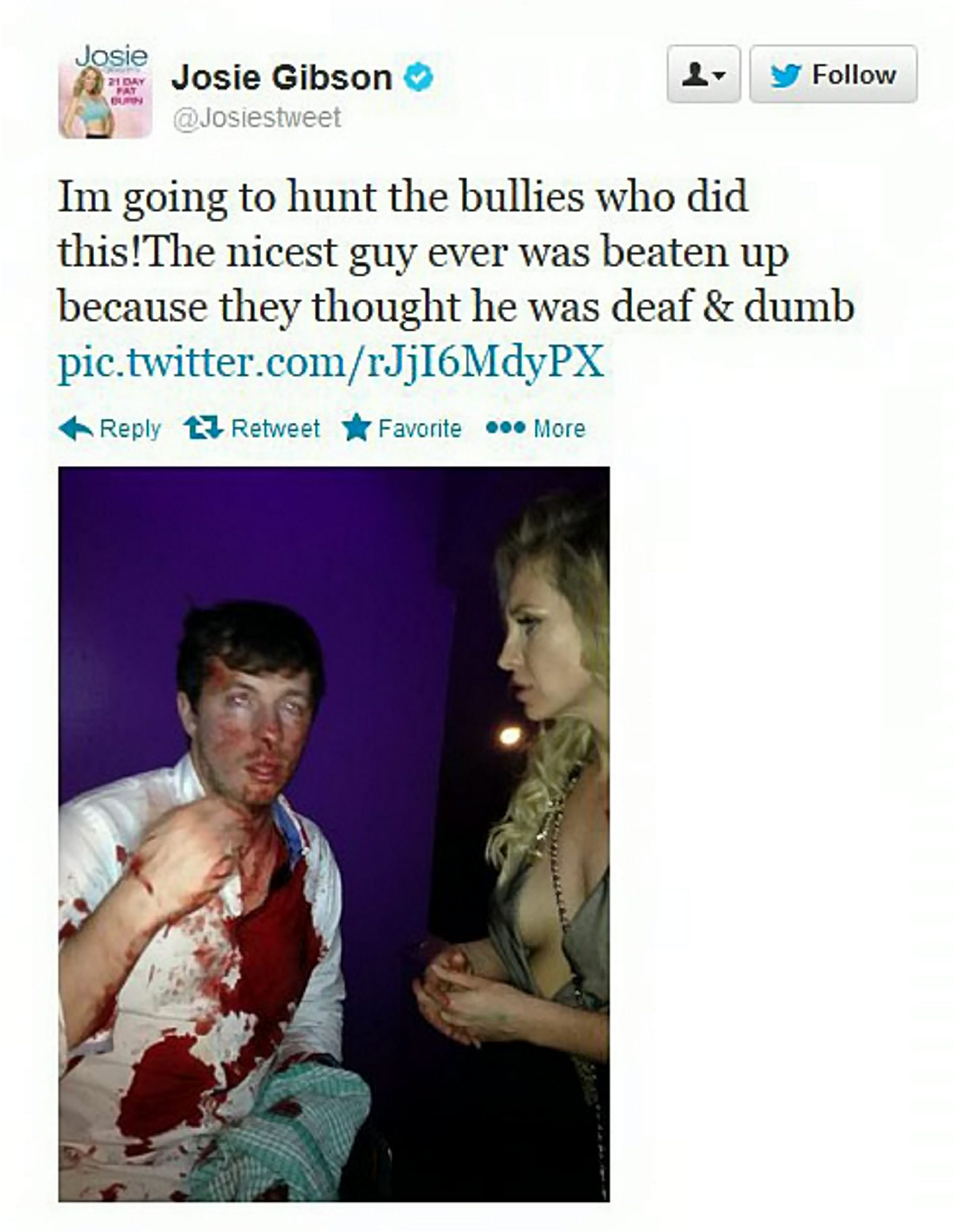 BB's Josie Gibson Tweets Her Fury