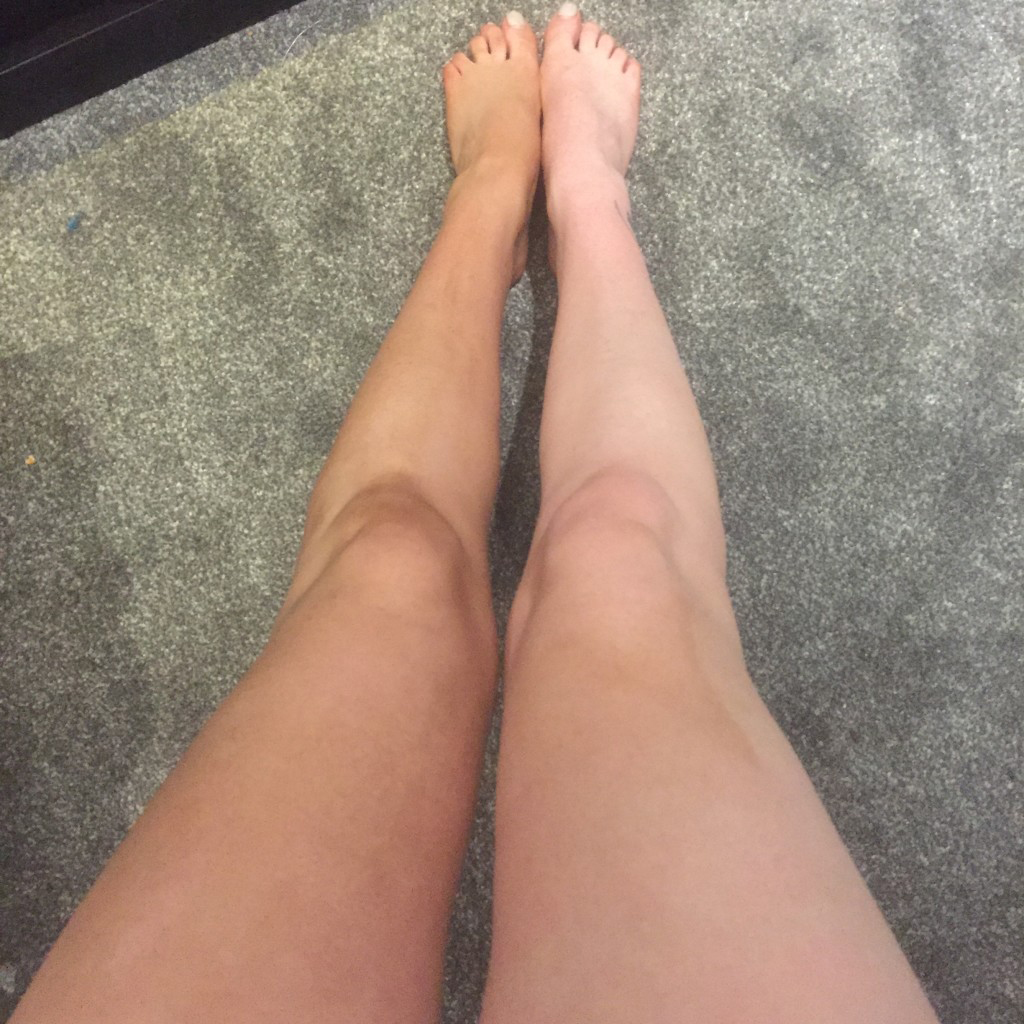 To tan or not to tan- that is the question