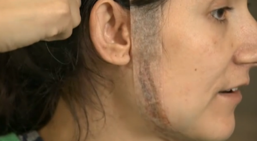 Scarred for life: The results of this horrific attack