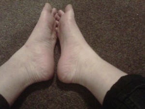 'Before' shot of my feet