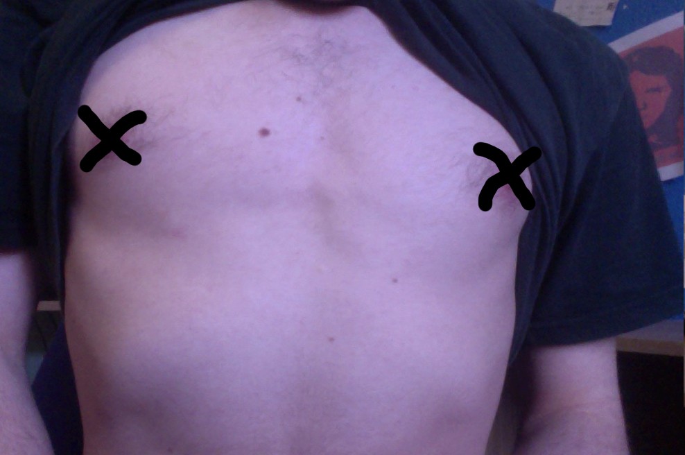 Nipple 1