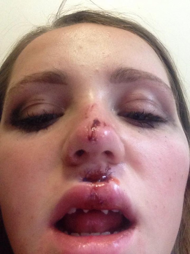 Turf 1 – Carter 0