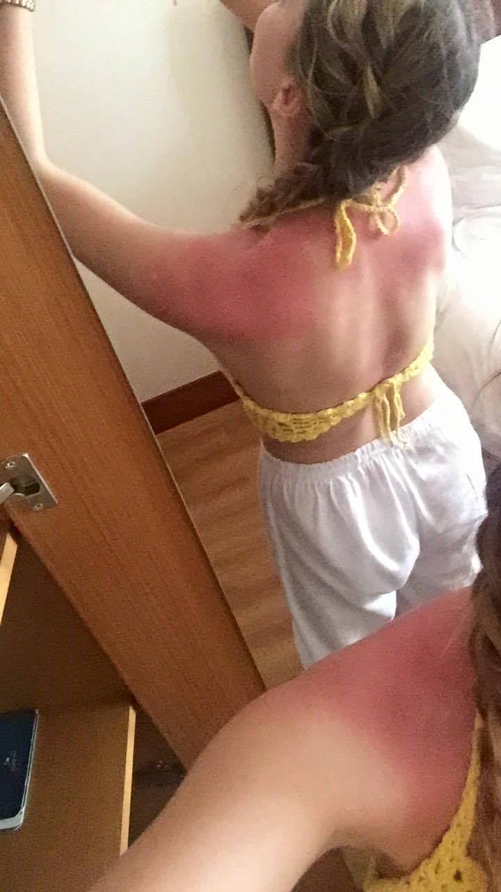 They bought new clothes, but forgot the suncream
