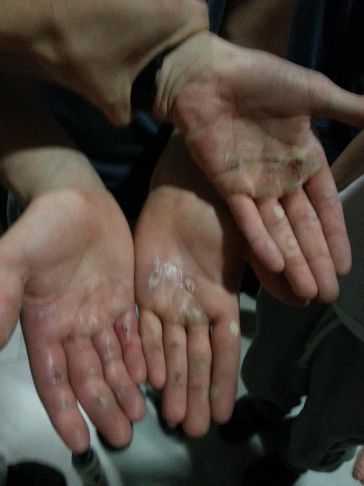 Just moisturise, right?