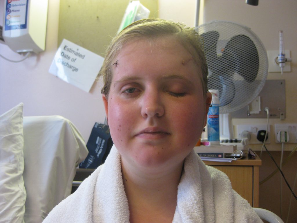 Izzy after her second operation