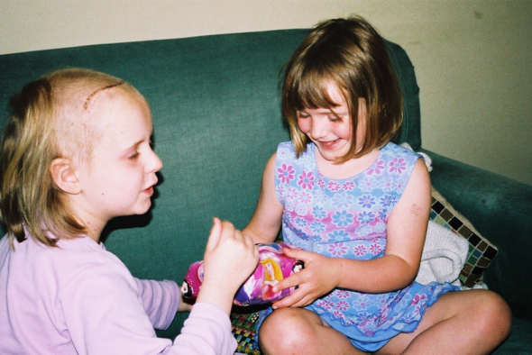 Izzy aged 9 nd her sister after her first operation