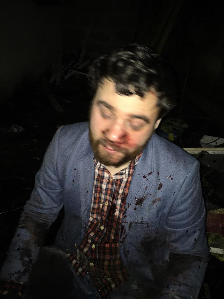 The man who fell through the roof of a house in Devon. See SWNS story SWINTRUDER: A couple has released images of a bloodied drunk student - who fell through their ROOF. Shocked Chris and Lou Hepper were asleep in bed at home when their dog suddenly started barking at around 1.45am. After hearing a strange noise, Chris, 32, looked outside and saw a stranger had fallen 10ft from their garden wall and through their garage roof. He was dazed, confused and bloodied - with a gash on his face.