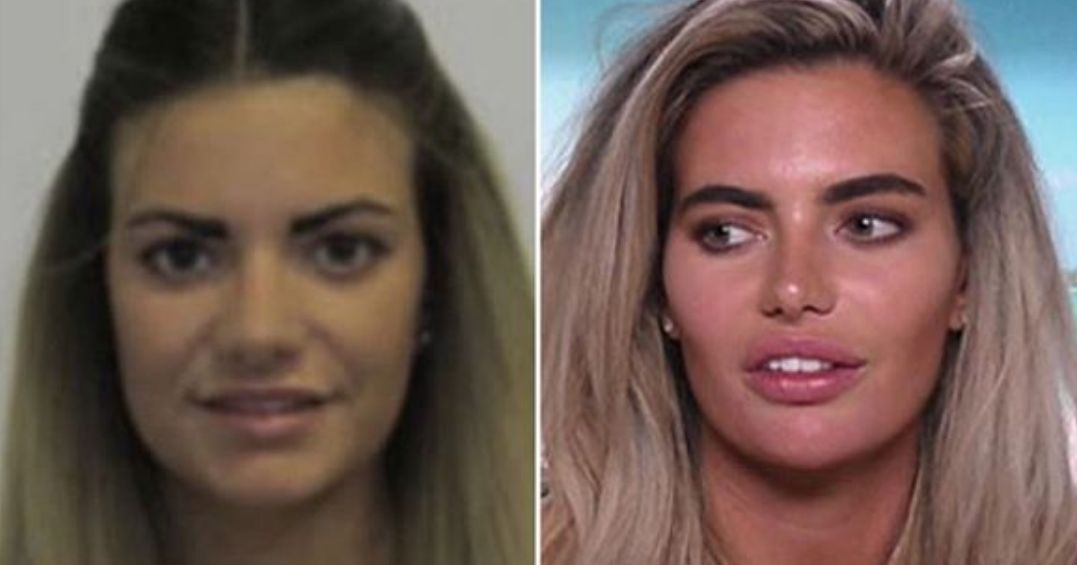Megan Love Island before surgery: There’s a new, third picture