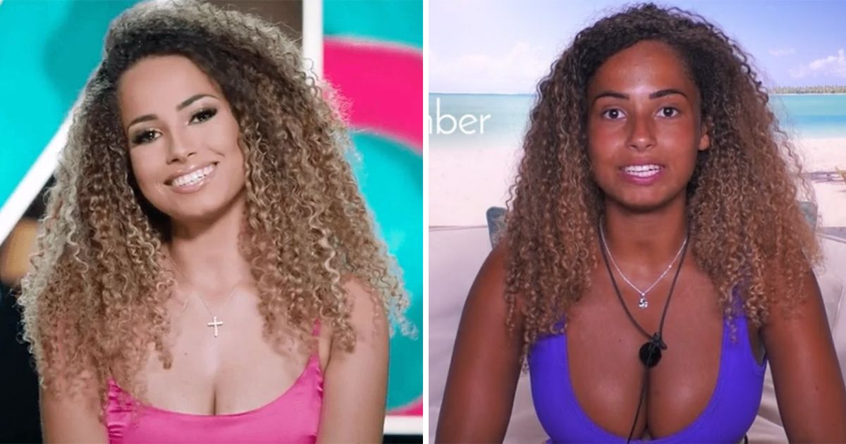 Image may contain: Love Island tans, Love Island, tan, burn, sun, before, after, tanformation, Amber, Girl, Hair, Woman, Pendant, Female, Person, Human, Face