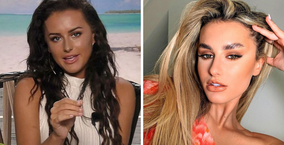 Love Island Transformations Ex Islanders Look Totally Different Then To Now