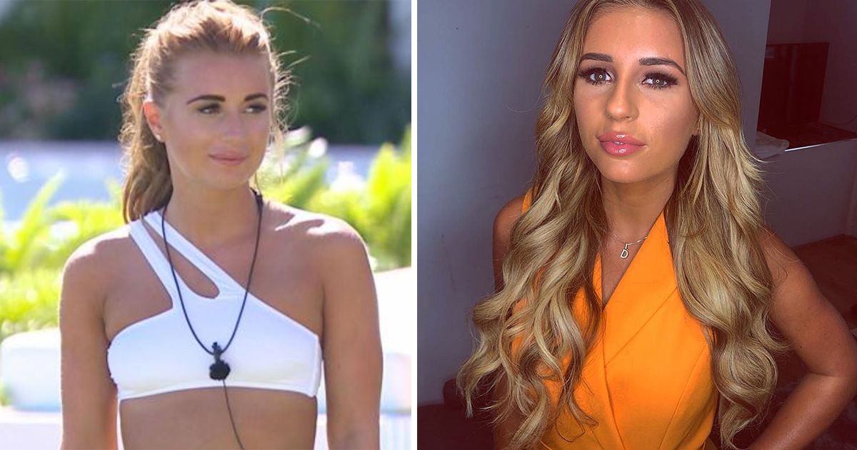 Image may contain: Love Island transformations, Love Island, 2018, series four, Dani Dyer, then, now, before, after, plastic, cosmetic, surgery, filler, lips, boob job, veneers, teeth, glow up, change, Face, Female, Clothing, Apparel, Person, Human, Pendant