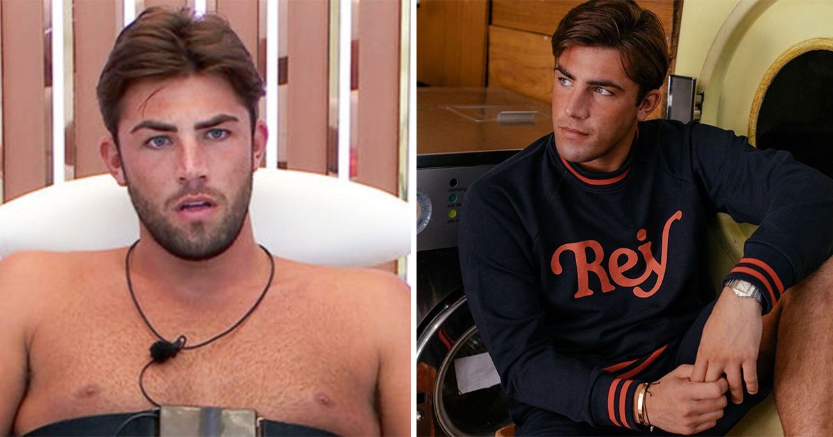 Image may contain: Love Island transformations, Love Island, 2018, series four, Jack Fincham, then, now, before, after, plastic, cosmetic, surgery, filler, lips, boob job, veneers, teeth, glow up, change, Man, Face, Person, Human