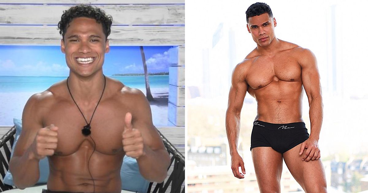 Image may contain: Love Island transformations, Love Island, 2016, series two, Rykard Jenkins, then, now, before, after, plastic, cosmetic, surgery, filler, lips, boob job, veneers, teeth, glow up, change, Photo, Photography, Finger, Thumbs Up, Man, Face, Human, Person