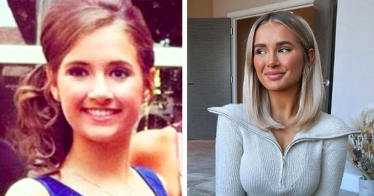molly mae plastic surgery Image 9