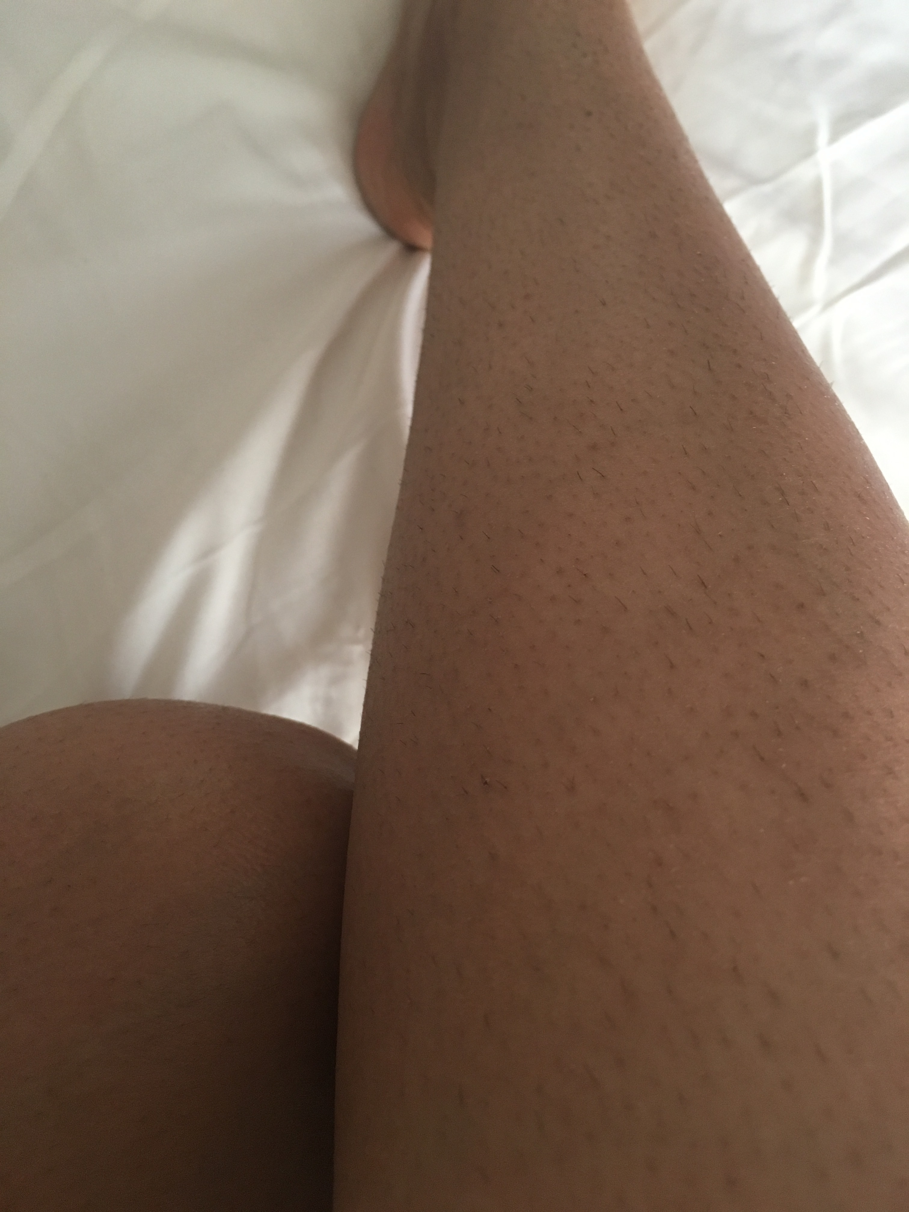 You can clearly see the hairs that I am so afraid of.