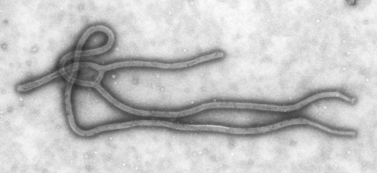 Ebola_Virus_TEM_PHIL_1832_lores