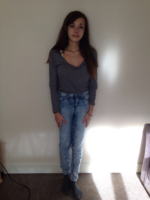 UEA third year Alice recovered from anorexia