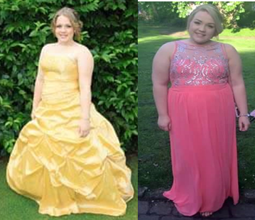(Left) Hannah At her Prom (right) Hannah at her Uni ball