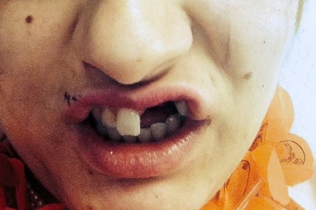 teeth1