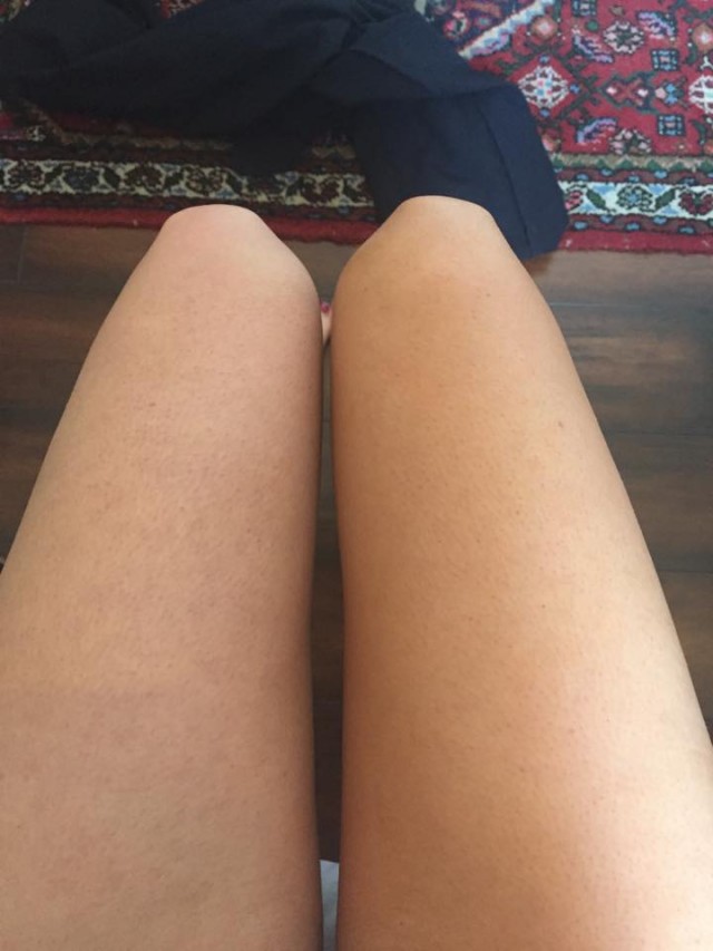Left (natural) and right (tanned)