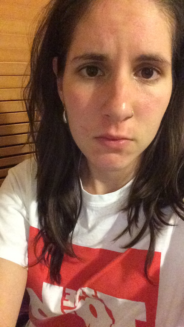 Sara Burned Face