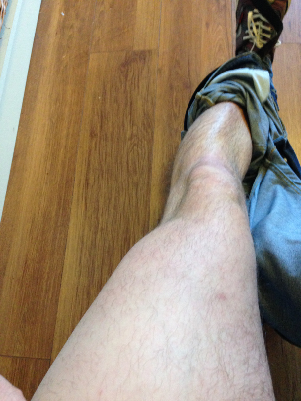 leg