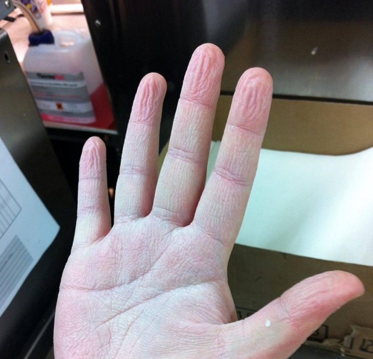 What your hand looks like after you've done the dive